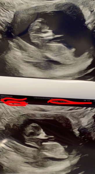 April 2022 Birth Club