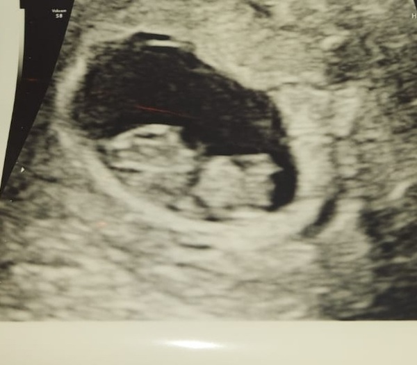 4 weeks BFP
