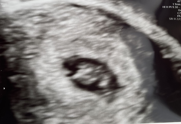 Due May 22
