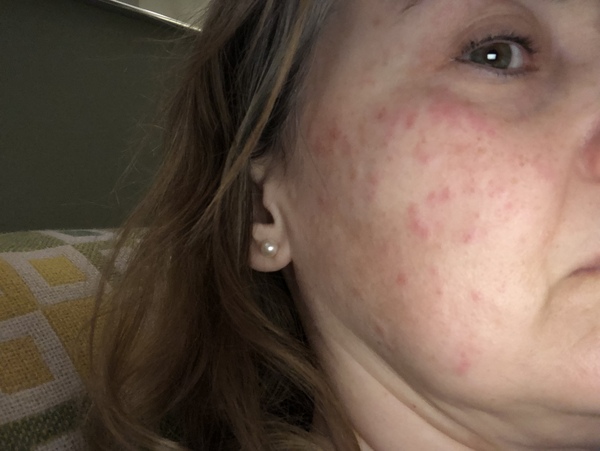 I’ve developed spots pretty much overnight