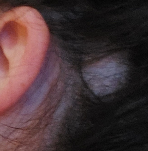 Bald patch with pics