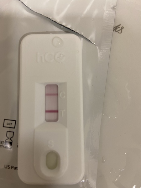 Have I had a missed miscarriage?