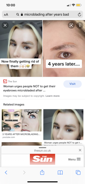 Would I benefit from having eyebrow microblading?