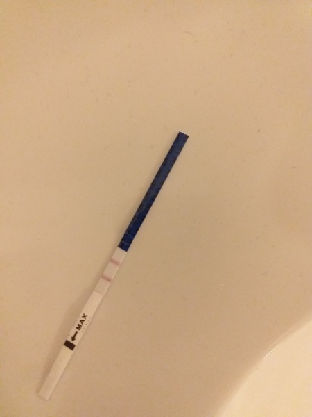 Delayed missed miscarriage and had to have the d&c