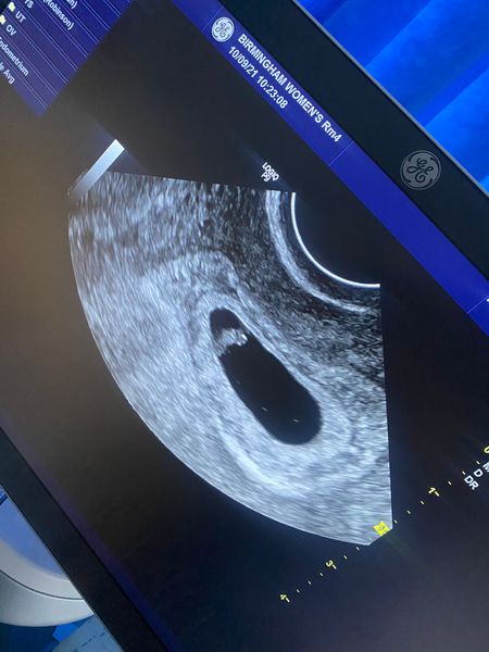 Ramzi theory anyone? 7 weeks scan
