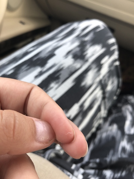 The best thing your body has produced *warning-grim content not suitable for weak-stomached persons*