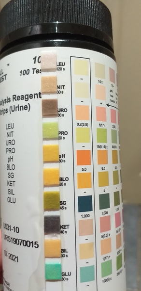 Feeling tired, odema, put in a stone in a month, breathless. Gp insists I am fine.