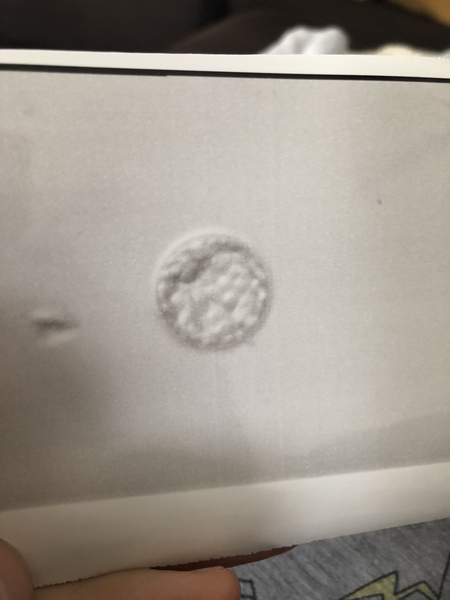 IVF , do you inject ovaleap injection in thigh or tummy?