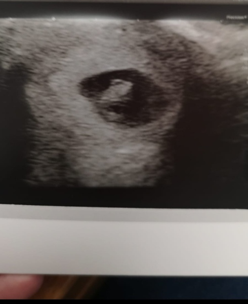 Give my my bfp!!! 🙈🙌🤞🤞