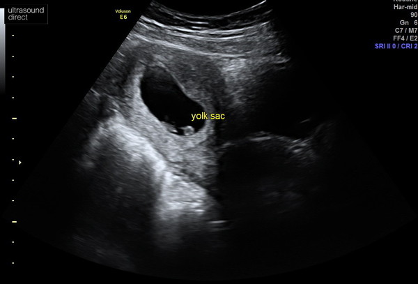 Due May 22