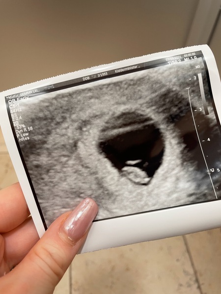 🤰🏼April 2022 Birth thread 🤰🏼