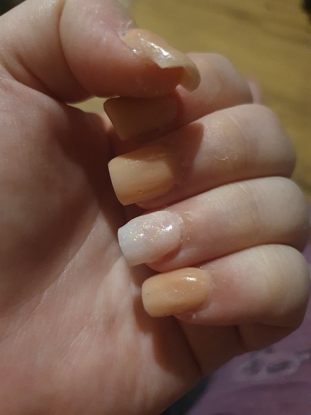 Chronic Pain- Daily chat drop in thread #2 All welcome