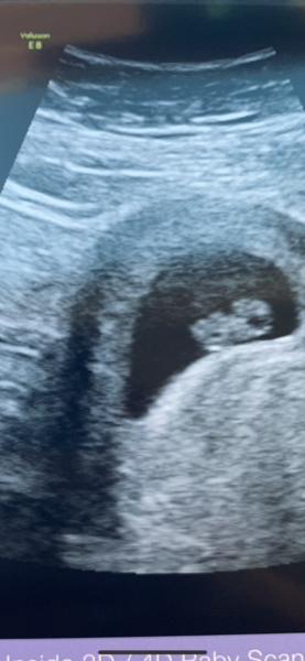 Tracking your cycle and possible BFP using RHR - part 6