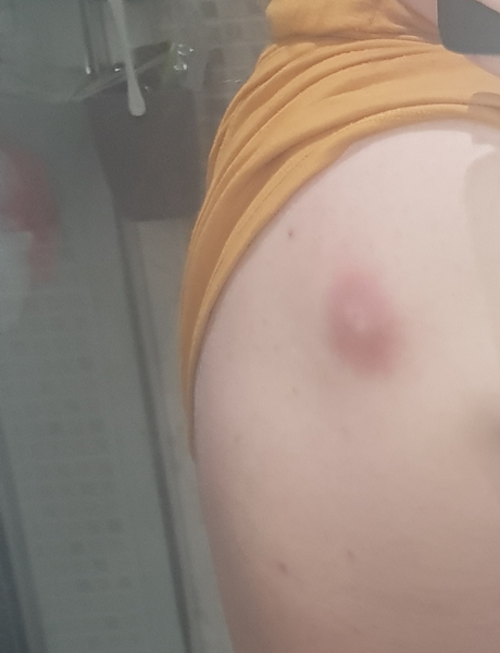 Havent been able to see a GP, bit concerned, bit gross now...