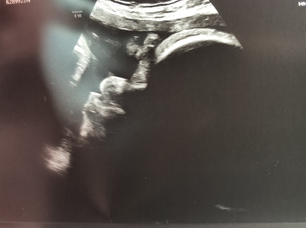 🍼👶🏼👣 MAMAS DUE OCTOBER 2021 👣👶🏼🍼