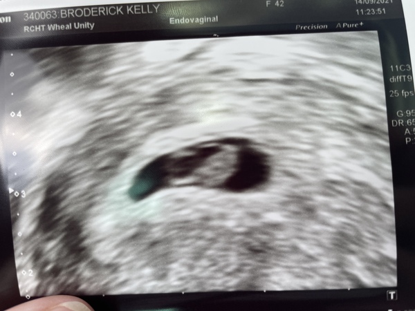 April 2022 Birth Club