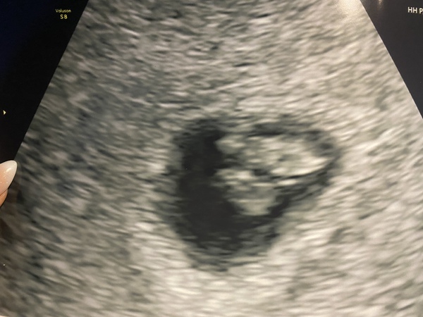 Due May 2022 Thread 2