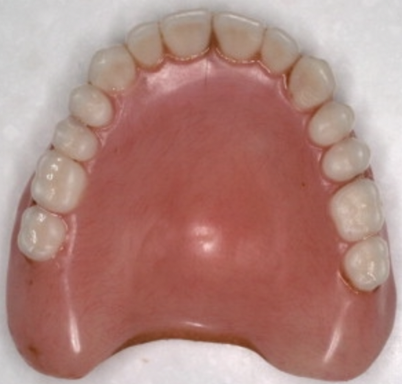 To want to get dentures?