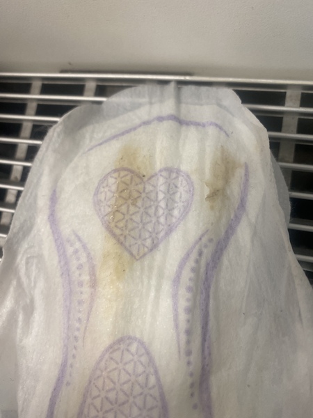Is This Meconium?