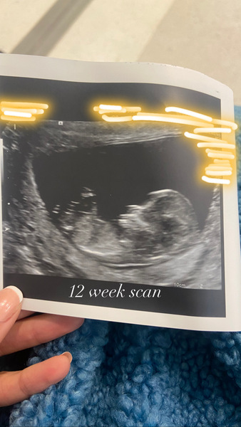 Any gender guessers / sonographers out there? 20 week scan