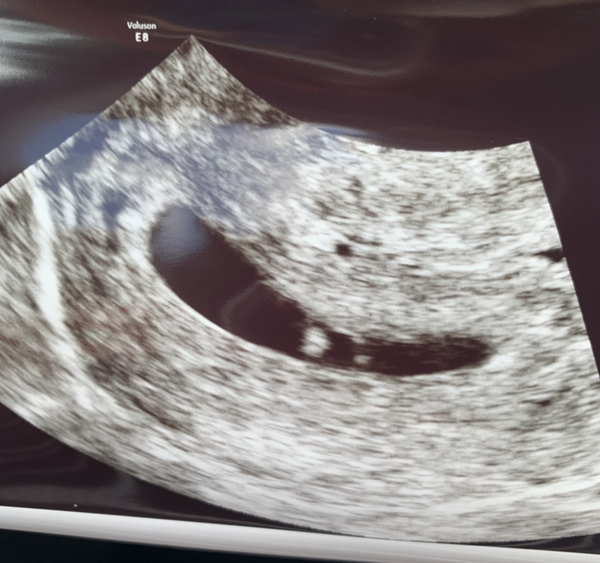 Tracking your cycle and possible BFP using RHR - part 6