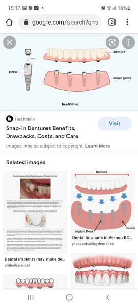 To want to get dentures?