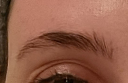 Would I benefit from having eyebrow microblading?