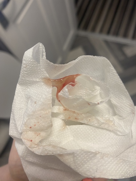 Is this my mucus Plug