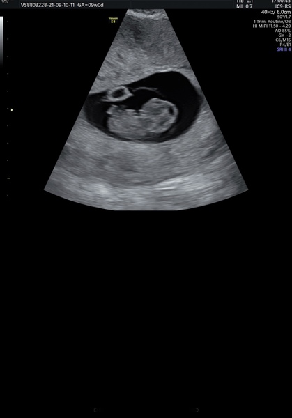 🤰🏼April 2022 Birth thread 🤰🏼