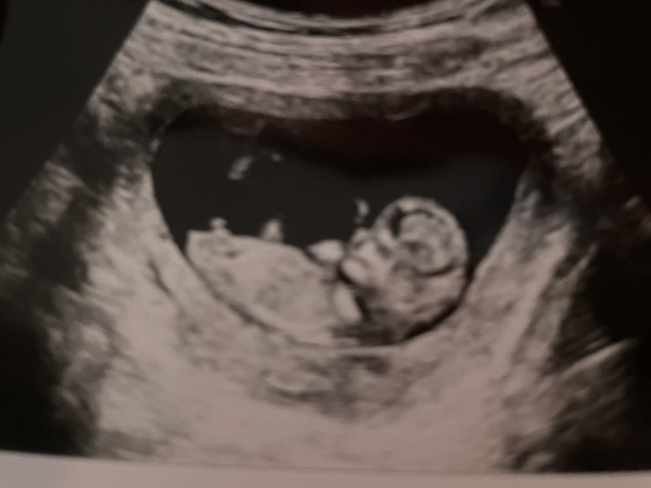 Gender guesses?