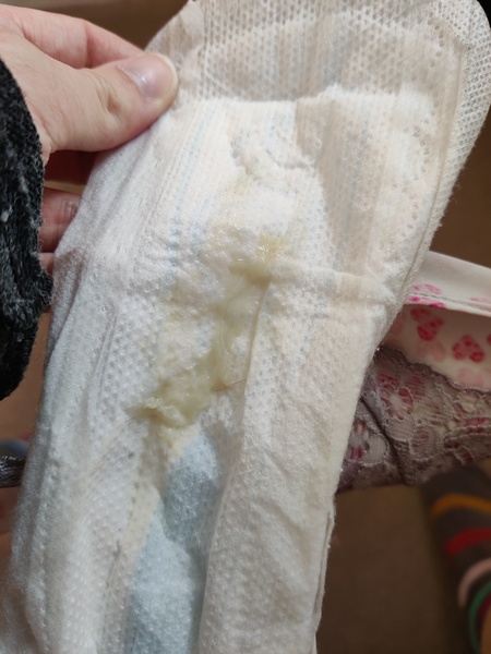 TMI - is this mucous plug? Pic attached