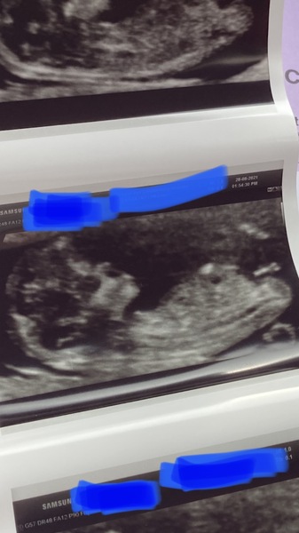 Do you want me to guess the sex? 12 week scans.