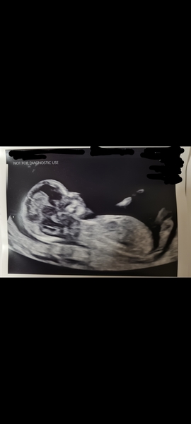 Boy or girl?