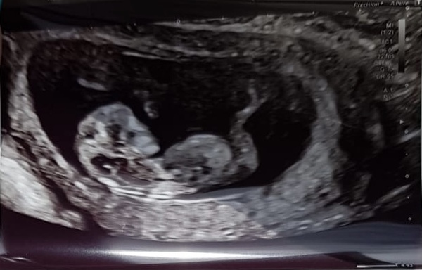 Boy or girl 👧 👦