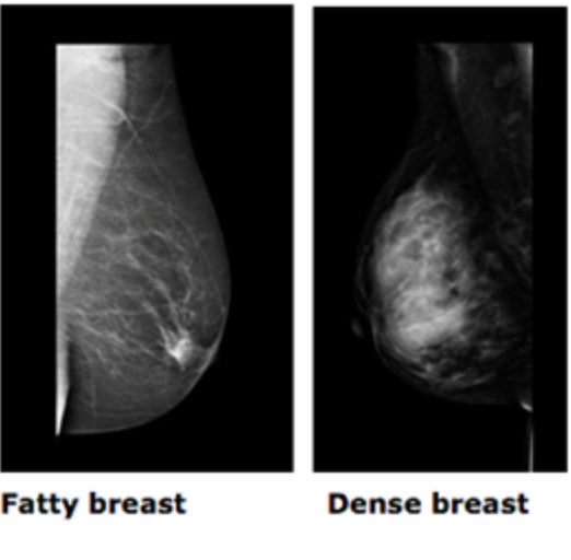 Post mammogram follow up