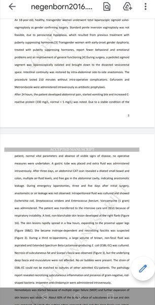 The judgment in Keira Bell's case will be given tomorrow