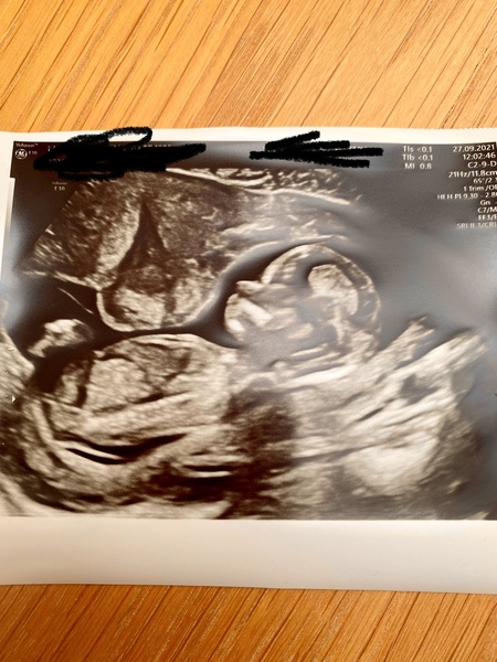 Your guesses - boy or girl?!