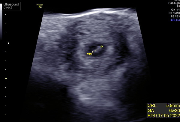 Due May 2022 Thread 2
