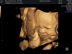 4D / HD live scan timing