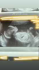 Any gender guessers / sonographers out there? 20 week scan