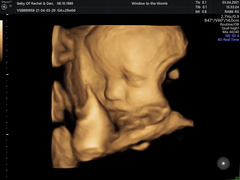 4D / HD live scan timing