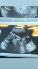 Any gender guessers / sonographers out there? 20 week scan