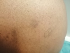 My daughter hurts me :(
