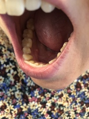 Any dentists? Does this look at all sinister or worrying?