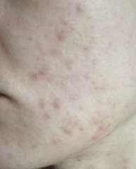 RETINOL - I'm a new comer and have no idea!