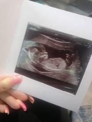 How accurate is the skull theory?