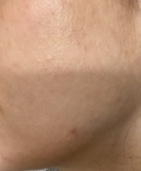 RETINOL - I'm a new comer and have no idea!