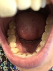 Any dentists? Does this look at all sinister or worrying?