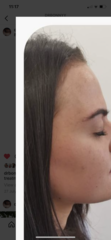 Struggle with baby hairs/ hairline