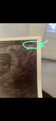 Help! How far along am I?